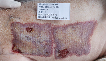 深II度烫伤模型